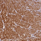 Immunohistochemical staining of human prostate shows strong cytoplasmic positivity in smooth muscle cells.