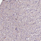 Immunohistochemical staining of human liver shows no positivity in hepatocytes as expected.