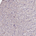 Immunohistochemical staining of human liver shows no positivity in hepatocytes as expected.