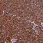 Anti-C15orf52 Antibody