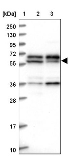 Lane 1: Marker [kDa] 250, 130, 95, 72, 55, 36, 28, 17, 10_br/_Lane 2: Human cell line RT-4_br/_Lane 3: Human cell line U-251MG sp