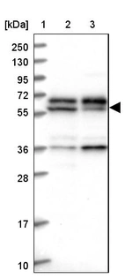 Lane 1: Marker [kDa] 250, 130, 95, 72, 55, 36, 28, 17, 10_br/_Lane 2: Human cell line RT-4_br/_Lane 3: Human cell line U-251MG sp