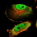 Immunofluorescent staining of human cell line U-251 MG shows localization to nucleoplasm & cytosol.