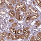 Anti-CILP2 Antibody