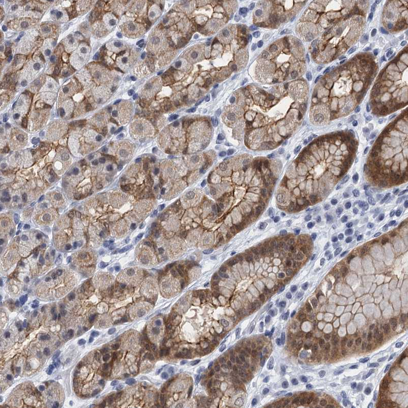 Anti-EPS8L1 Antibody