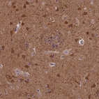 Anti-TNK2 Antibody