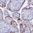 Anti-KCTD21 Antibody