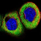 Immunofluorescent staining of human cell line A-431 shows localization to cytosol.