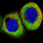 Immunofluorescent staining of human cell line A-431 shows localization to cytosol.