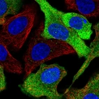 Immunofluorescent staining of human cell line A549 shows localization to cytosol.