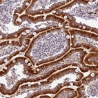 Anti-HEATR5B Antibody