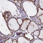 Immunohistochemical staining of human thyroid gland shows high expression.