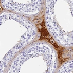 Immunohistochemical staining of human testis shows strong plasma positivity.