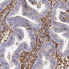 Immunohistochemical staining of human endometrium shows strong strong plasma positivity.