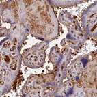Immunohistochemical staining of human placenta shows strong strong plasma positivity.