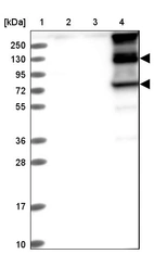 Lane 1: Marker [kDa] 250, 130, 95, 72, 55, 36, 28, 17, 10_br/_Lane 2: Human cell line RT-4_br/_Lane 3: Human cell line U-251MG sp_br/_Lane 4: Human plasma (IgG/HSA depleted)