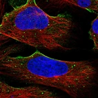 Immunofluorescent staining of human cell line U-2 OS shows localization to vesicles.