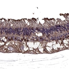 Immunohistochemical staining of human eye shows strong cytoplasmic positivity in photoreceptor cells.