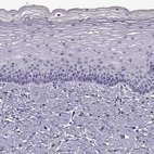 Immunohistochemical staining of human cervix shows no positivity in squamous epithelial cells as expected.
