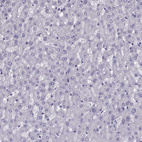 Anti-RLBP1 Antibody