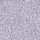 Immunohistochemical staining of human liver shows no positivity in hepatocytes as expected.