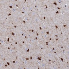 Anti-PPP1R14A Antibody