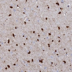 Immunohistochemical staining of human cerebral cortex shows high expression.