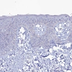 Immunohistochemical staining of human skin shows low expression as expected.
