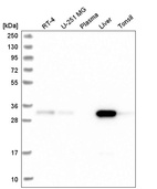 Western blot analysis in human cell line RT-4, human cell line U-251 MG, human plasma, human liver tissue and human tonsil tissue.