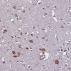 Anti-KCNE5 Antibody