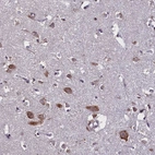 Anti-KCNE5 Antibody