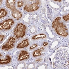 Anti-TMEM78 Antibody