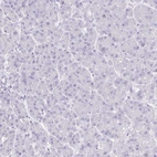 Immunohistochemical staining of human pancreas shows no positivity in exocrine glandular cells as expected.