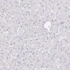 Immunohistochemical staining of human liver shows no positivity in hepatocytes as expected.