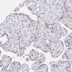 Immunohistochemical staining of human placenta shows weak to moderate nuclear positivity in trophoblastic cells.