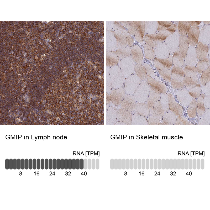 Anti-GMIP Antibody
