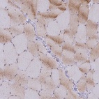 Immunohistochemical staining of human skeletal muscle shows low expression as expected.