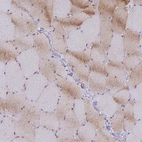 Immunohistochemical staining of human skeletal muscle shows low expression as expected.