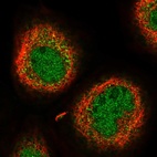 Immunofluorescent staining of human cell line A-431 shows localization to nucleoplasm & cytosol.