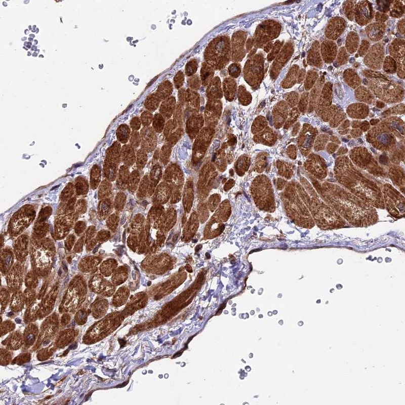 Anti-ESCO1 Antibody
