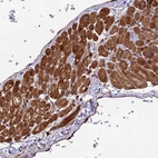 Anti-ESCO1 Antibody