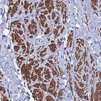 Anti-RAB39A Antibody