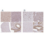 Anti-AKAP8L Antibody