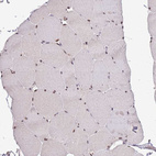 Immunohistochemical staining of human skeletal muscle shows strong nuclear positivity in myocytes.