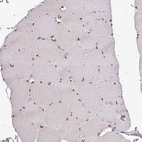 Immunohistochemical staining of human skeletal muscle shows strong nuclear positivity in myocytes.
