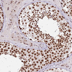 Immunohistochemical staining of human testis shows strong nuclear positivity in cells in seminiferous ducts.