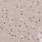 Immunohistochemical staining of human cerebral cortex shows strong nuclear positivity in neuronal cells.