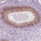 Immunohistochemical staining of human epididymis shows high expression.