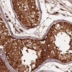Anti-RALGAPA2 Antibody