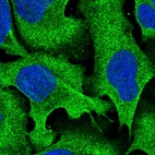 Anti-RALGAPA2 Antibody